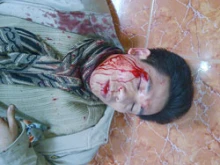 Br. Anthony Nguyen Van Tang after being beaten by police.