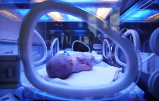 Newborn baby being treated in an incubator.   Petr Bonek/Shutterstock