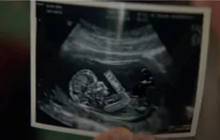 The ad, which aired during Super Bowl LVII on Feb. 12, 2023, featured a sonogram of a preborn baby. Pringles USA YouTube