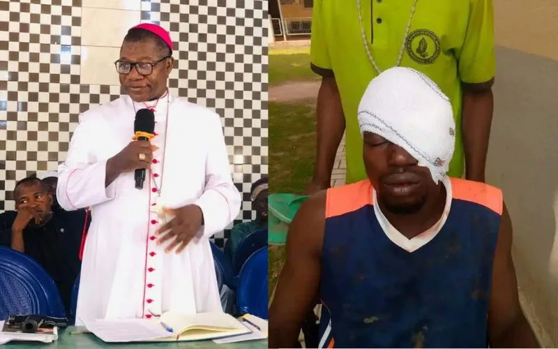 Bishop Mark Maigida Nzukwein of Nigeria's Wukari Diocese and one of the church stewards who lost an eye.