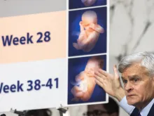 Ranking Member Sen. Bill Cassidy, R-Louisiana, speaks about the development of a preborn baby during a Senate Committee on Health hearing titled "The Assault on Women's Freedoms: How Abortion Bans Have Created a Health Care Nightmare Across America" on Capitol Hill on June 4, 2024, in Washington, D.C.
